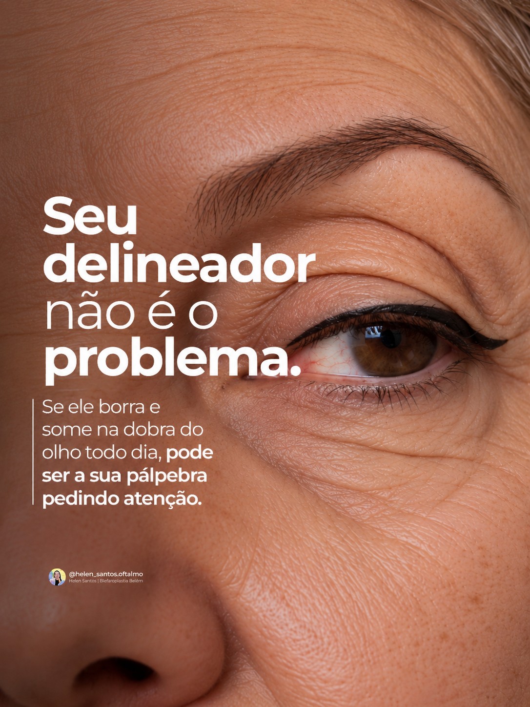 Peça 1