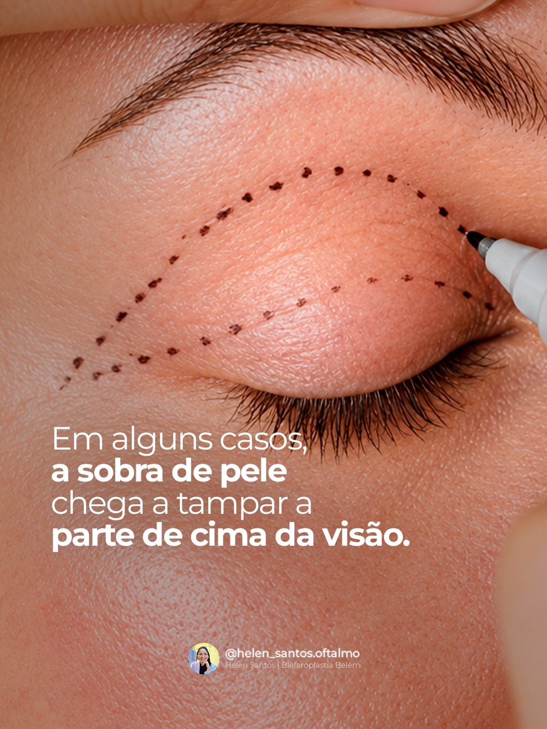 Peça 3